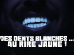 Replay Des dents blanches... au rire jaune !