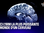 Replay L'image du jour - Voici l'IRM la plus précise au monde d'un cerveau (et elle est française)