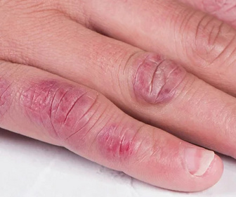 Replay Le Mag de la santé - 09/02/2026